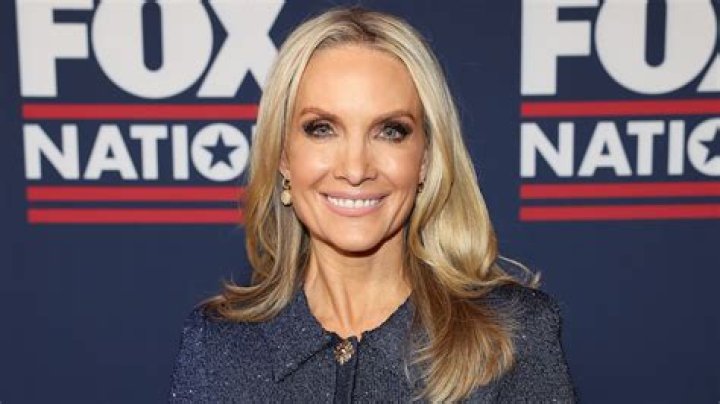 dana perino face lift: The Ultimate Guide to Her Journey and Transformation