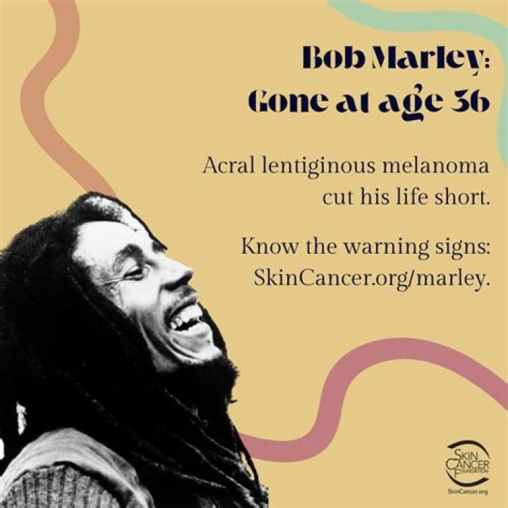 Did Bob Marley Die of Skin Cancer? Unveiling the Truth Behind the Legend