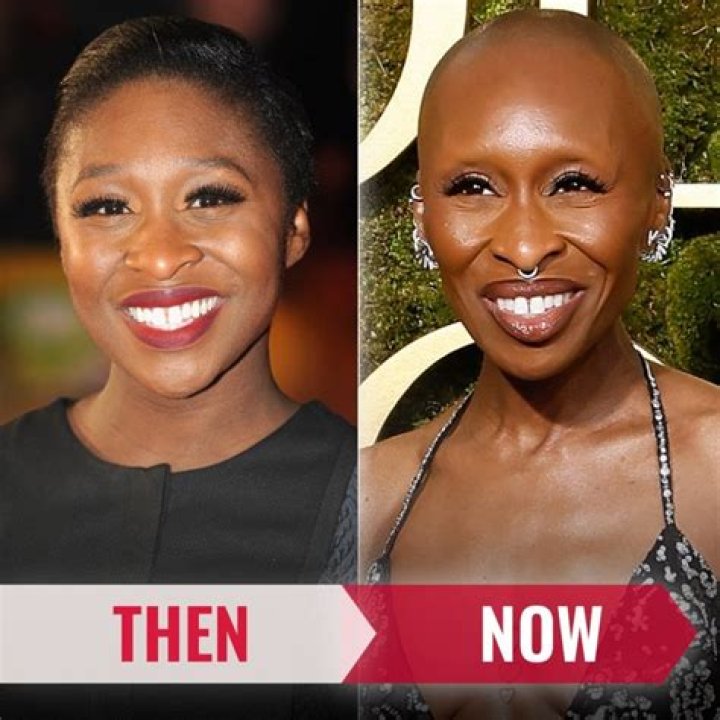 Does Cynthia Erivo Have Alopecia? Uncovering the Truth Behind the Rumors