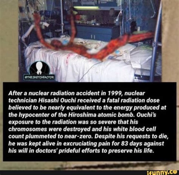 Hisashi Ouchi Autopsy Report: A Comprehensive Analysis