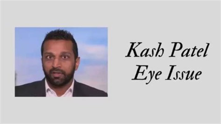 Kash Patel Eye Surgery: A Comprehensive Guide to Understanding the Procedure and Expertise