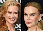 Nicole Kidman's Plastic Surgery: a Complete Guide to Her Transformations