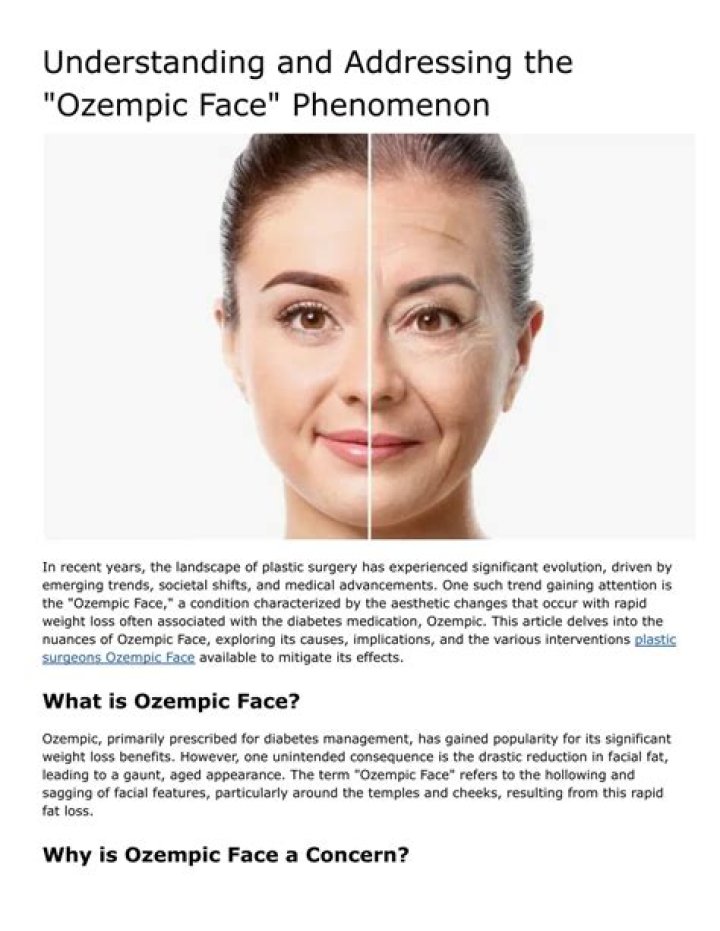Pics of Ozempic Face: A Comprehensive Guide to Understanding and Addressing the Phenomenon