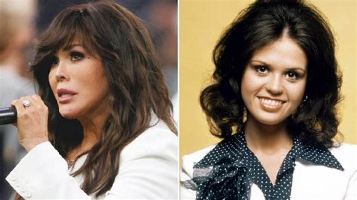 The Fascinating Age of Marie Osmond: A Journey Through Time