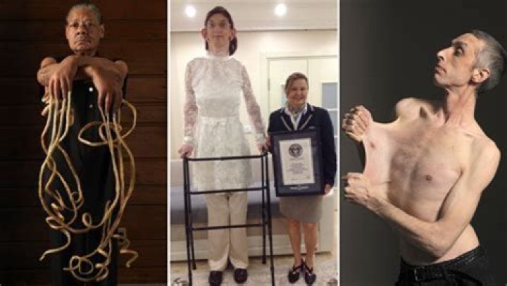 The Skinniest Person in the World: A Journey into Extreme Thinness