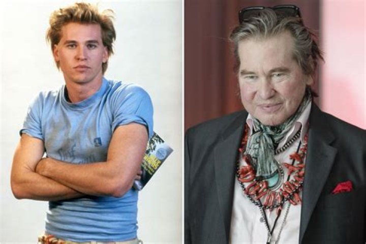 Val Kilmer Health: A Comprehensive Look at His Journey, Challenges, and Triumphs
