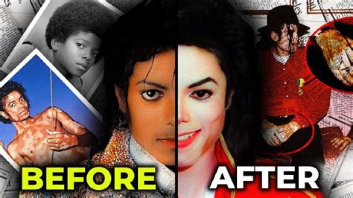 Why Did Michael Jackson Turn White: A Comprehensive Exploration